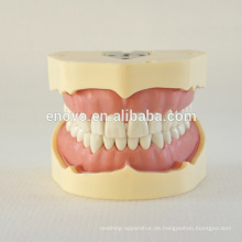 BF Typ Schraubenzähne Dental Studie Modell 13005, Ersatz Zähne Anzug für Frasaco Kiefer